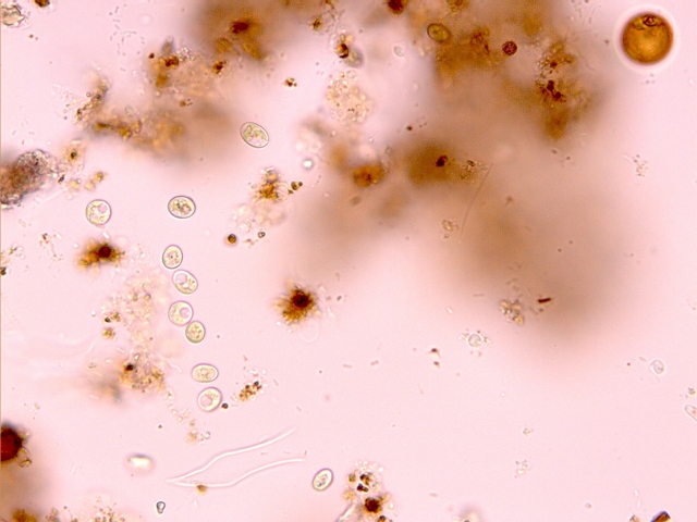 oocystis?